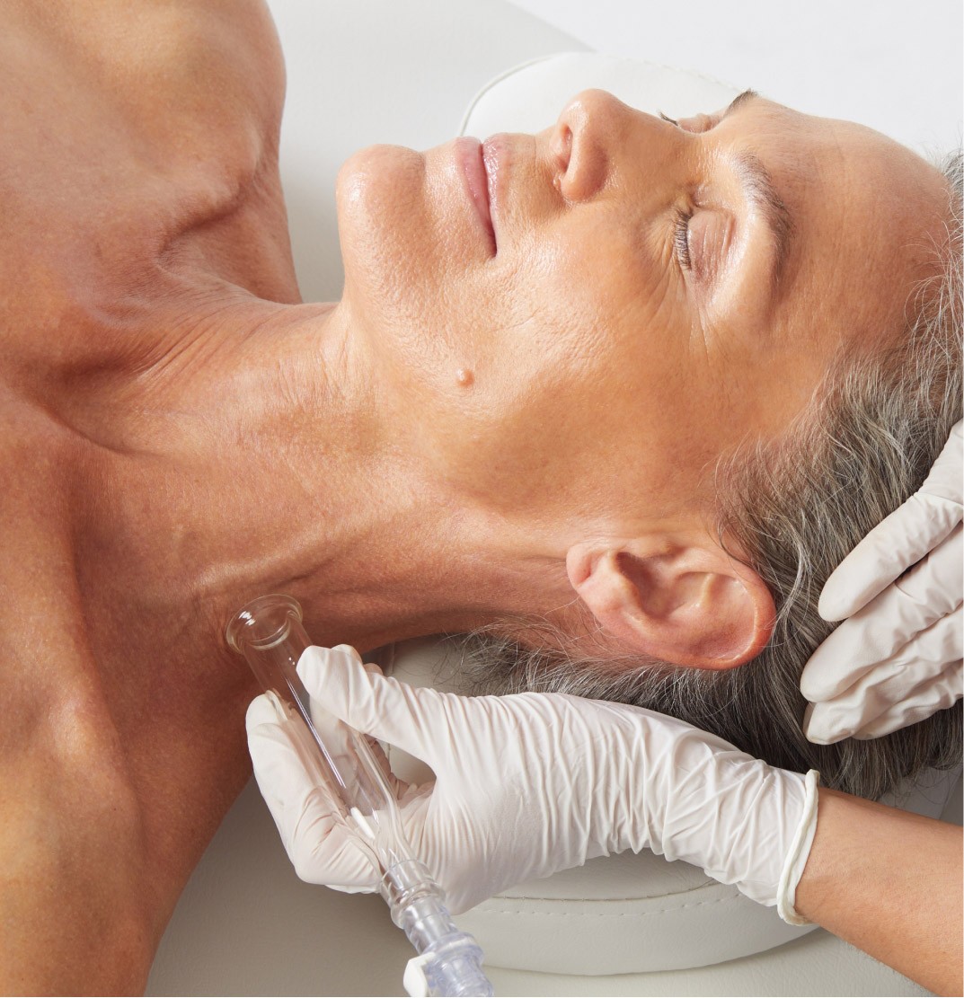 HydraFacial Image 4