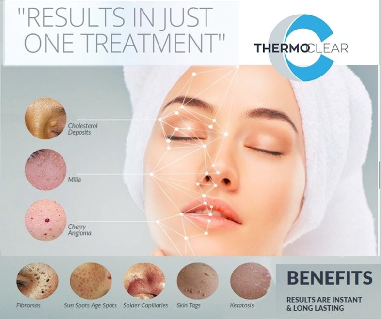 Thermo Clear Machine